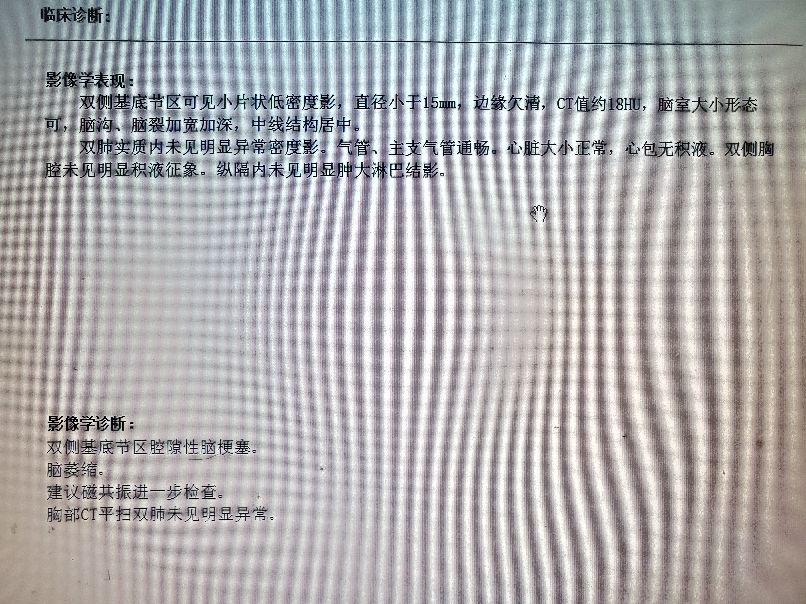 老年人颈椎病引起头晕恶心呕吐,头晕恶心干呕是不是颈椎病