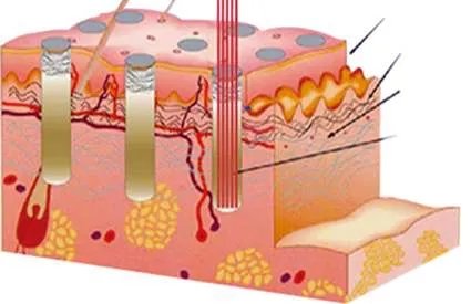 夏天出汗眼睛周围起疙瘩怎么回事,脸上眼睛周围有小米粒那样的疙瘩