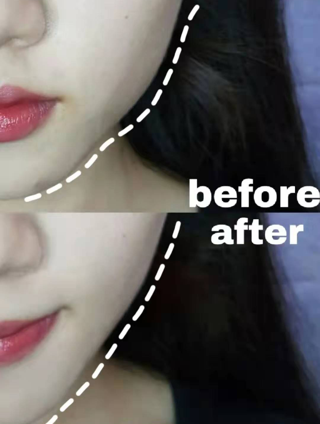 长期使用美容仪斑会淡吗,长期使用美容仪皮肤会提亮吗