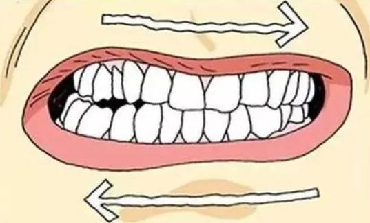 吃东西冷热交替牙受不了,冷热交替牙齿会裂开吗
