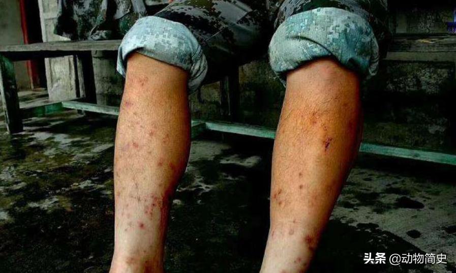 水蛭吸血疗法的正确方法,为什么水蛭吸血对身体有好处