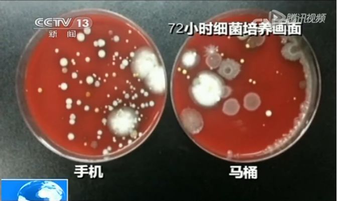 日本病毒传播试验,日本病毒感染实验