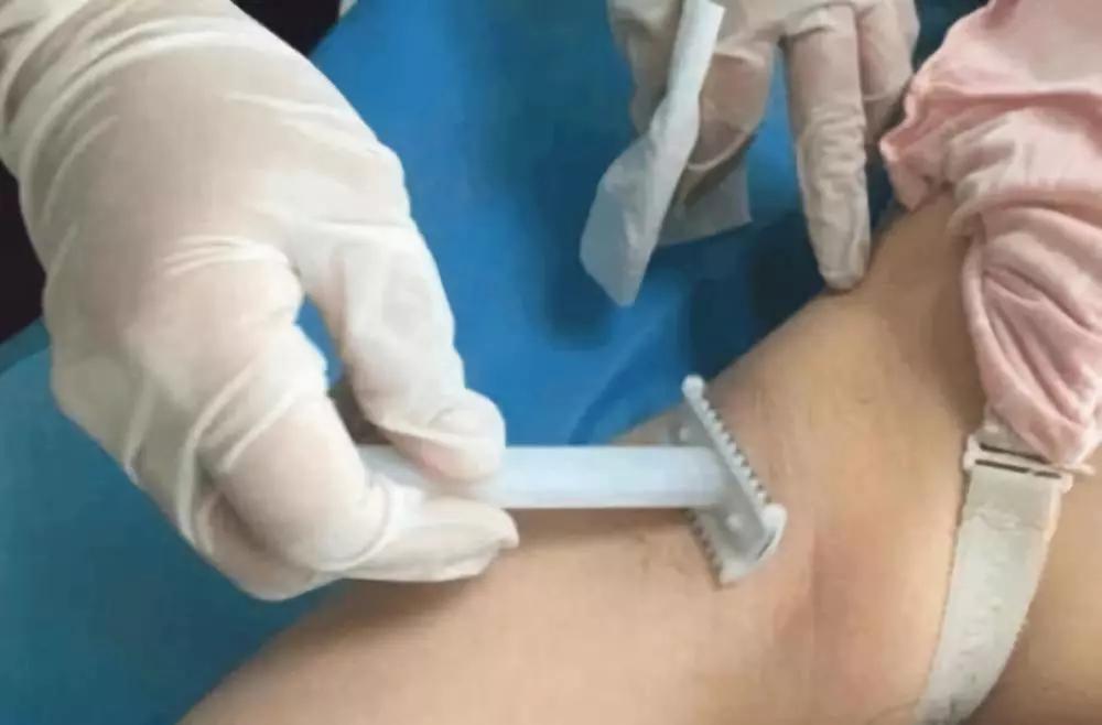 生孩子前要剪掉头发吗,生娃时需要自己刮体毛吗