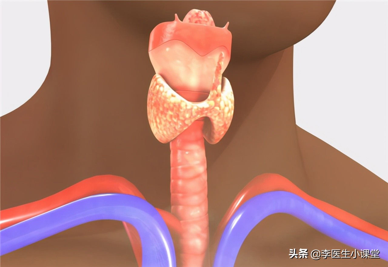 甲状腺全切后吃优甲乐有副作用吗,桥本氏甲状腺炎吃优甲乐有副作用