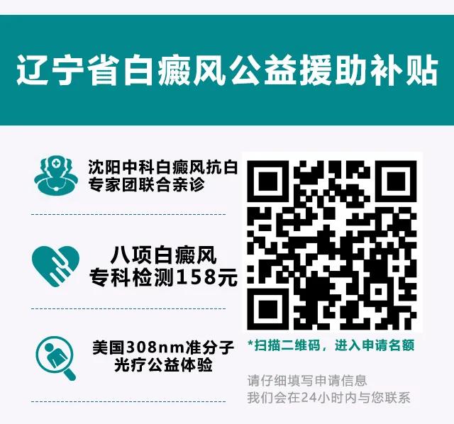 辽宁省白癜风专项诊疗补贴,白癜风专项资助