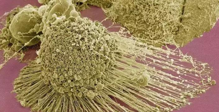 她拥有永生，靠此造福10亿人，死于癌症后，她的细胞带她重生！