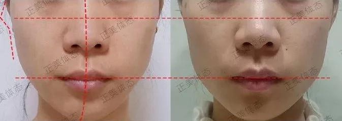 拯救颧骨高的教程,拯救脸大女生