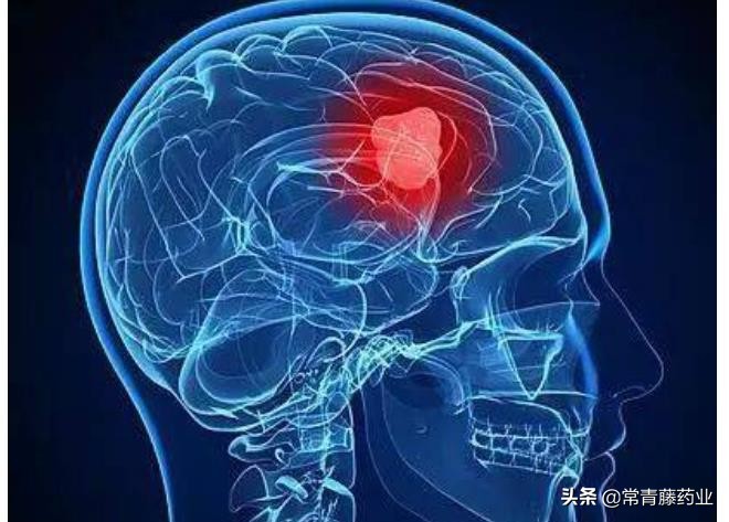 脑肿瘤的原因脑瘤是怎么引起的,脑瘤晚期应该怎么治疗