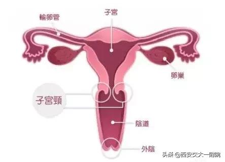 宫颈糜烂是真的假的,宫颈糜烂不是病是什么意思