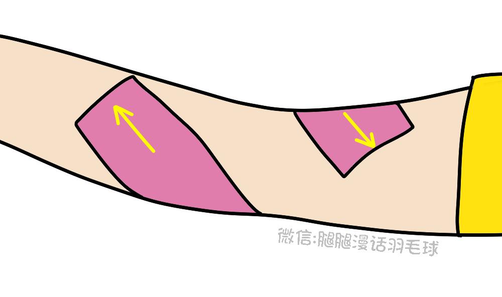 打球贴了肌效贴还用戴护膝吗,打球受伤了感觉不到疼