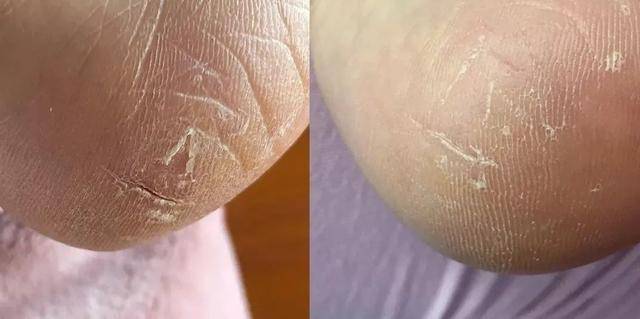 护肤国货片仔癀,护肤化妆品片仔癀