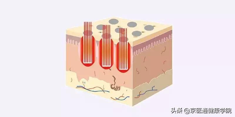 被吹上天却没什么用的保健品,被吹上天的阿胶