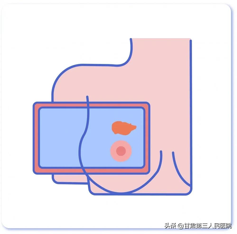 提到“乳房活检”，医生or患者在想些什么？