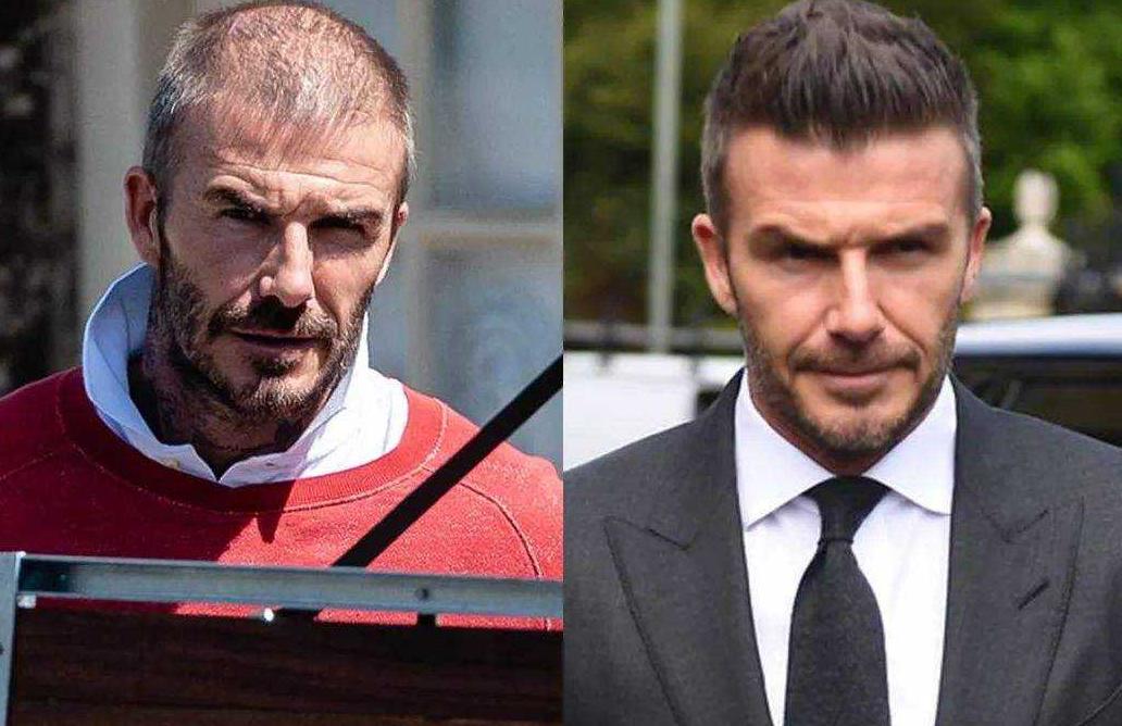 贝克汉姆真的脱发了吗,贝克汉姆被曝脱发角度问题