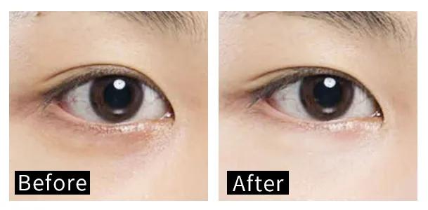 眼霜推荐去细纹黑眼圈平价,自己用过的一款眼霜推荐给大家