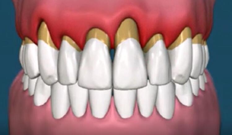 狗狗洗牙的良心忠告,医生忠告千万别洗牙