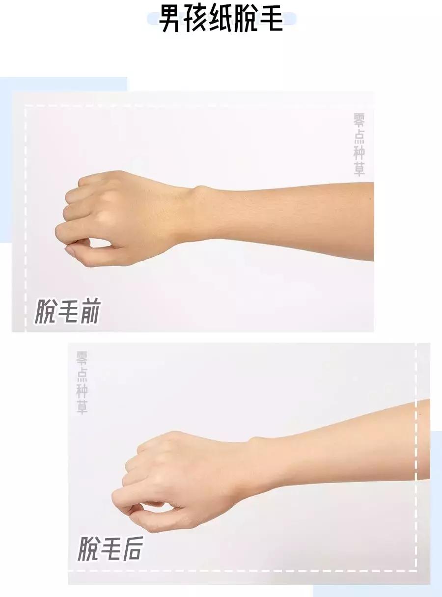 牛脱毛最快最有效的方法,土方脱毛最有效的方法