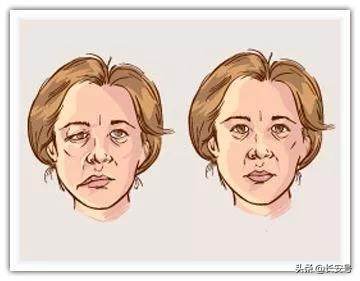 中风一侧手脚无力怎么恢复按摩图,医疗科普四肢无力是按摩惹的祸吗