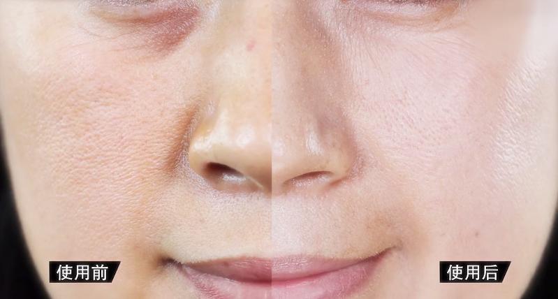 外国人有多怕衰老？法国皇室对抗老这么狂热？好夸张啊