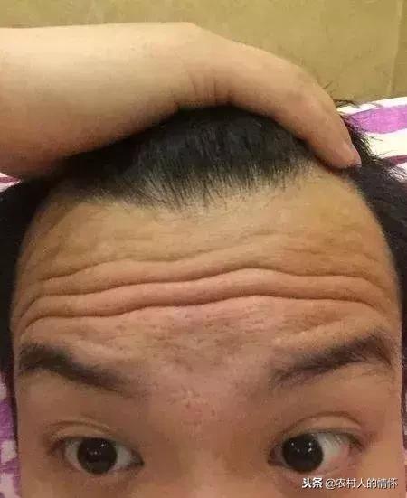 看额头三才纹知命运图解,男人额头有纹和地纹代表什么意思