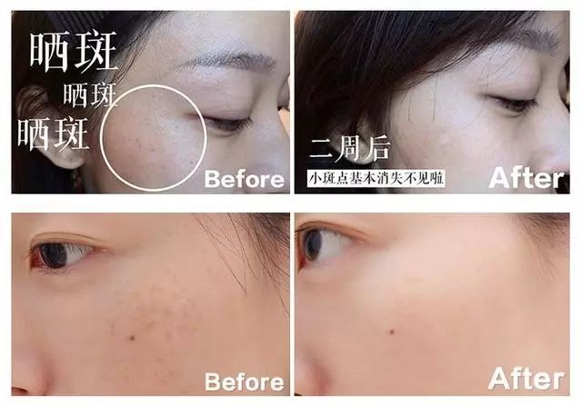 火到断货的“明星级”点斑笔,坚持每天点一下,14天养成初恋脸