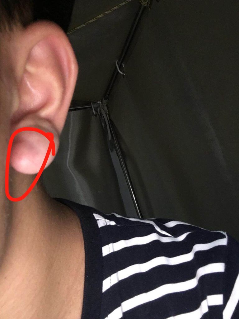 宝宝身上有这4个信号,宝宝身上这四个部位越脏越好