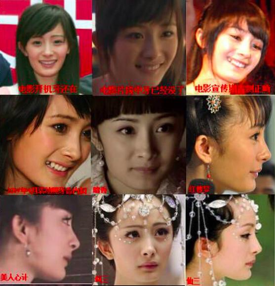 杨幂这些整容后遗症告诉你，不断返厂重修，代价得不偿失