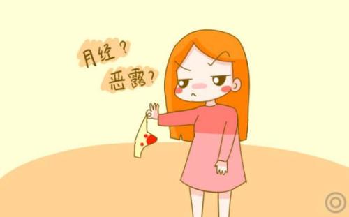 产后恶露10天左右干净正常吗,产后恶露哪些情况属于正常现象