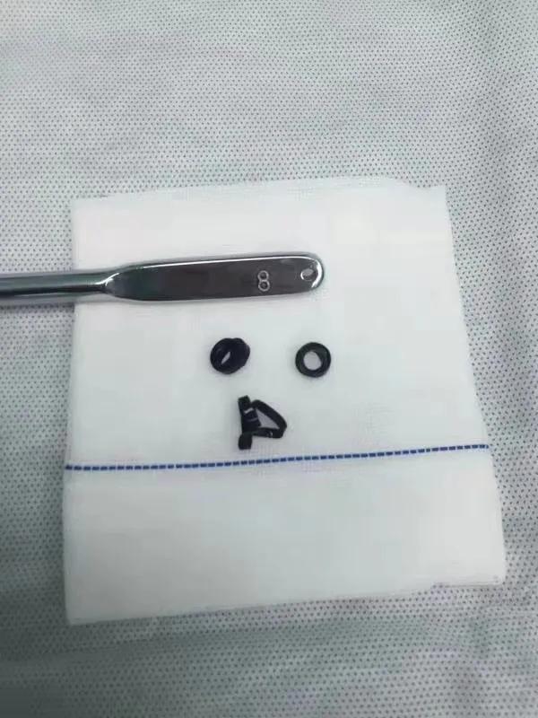 两岁女童吞异物危险,幼儿园女童遭男童塞异物