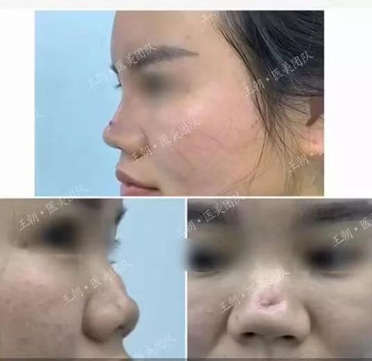 鼻子的颜值,颜值鼻子