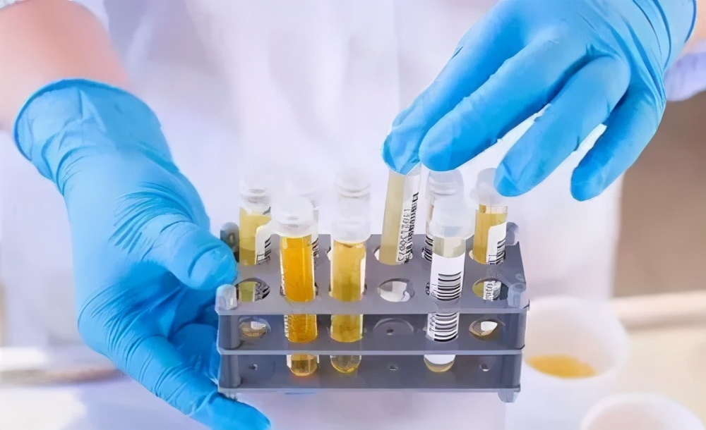 小便时疼是种怎样的体验?当心是这里的问题