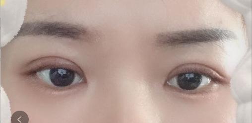 男的割双眼皮好看吗,割双眼皮好看吗动画