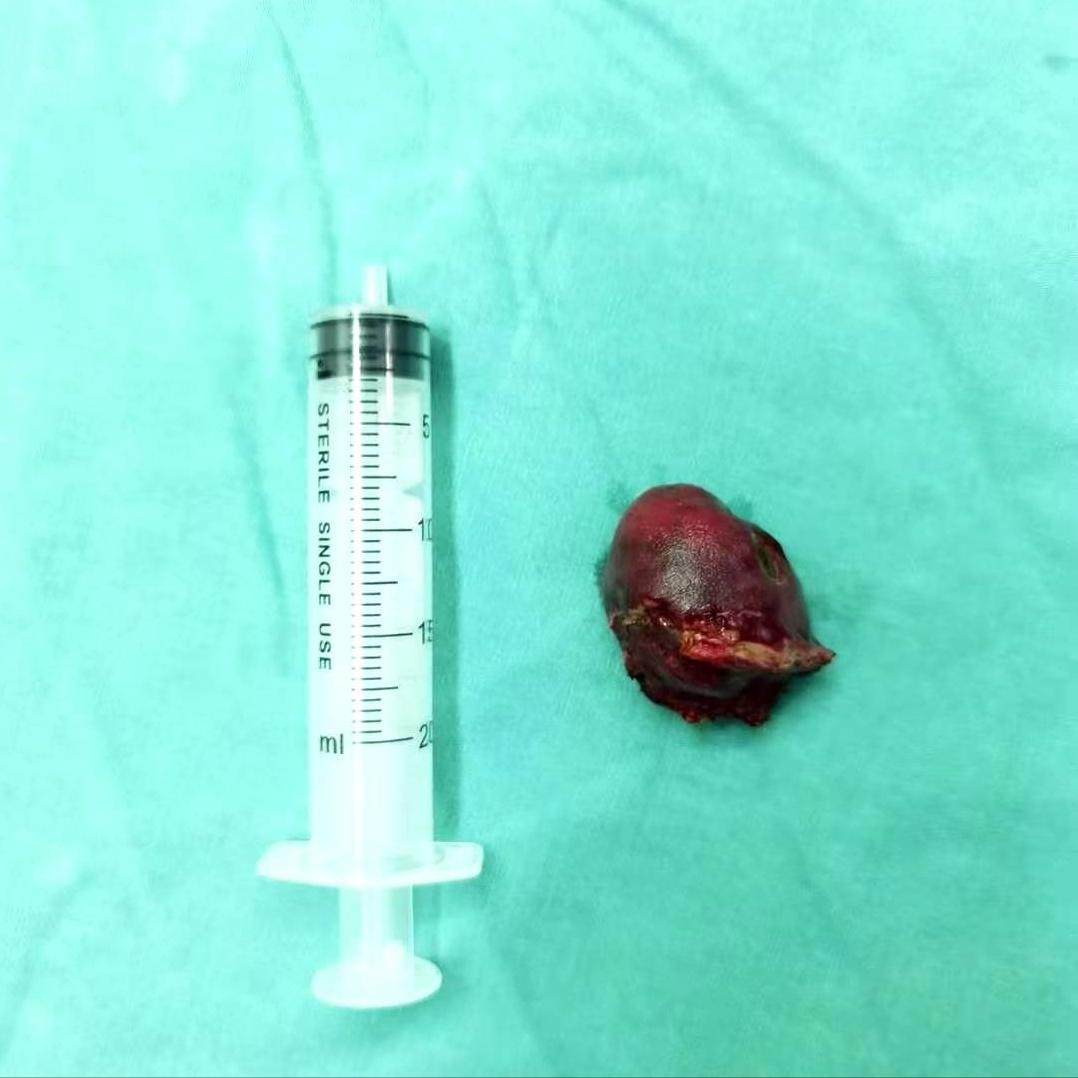 狡猾的它不是癌，却胜似癌