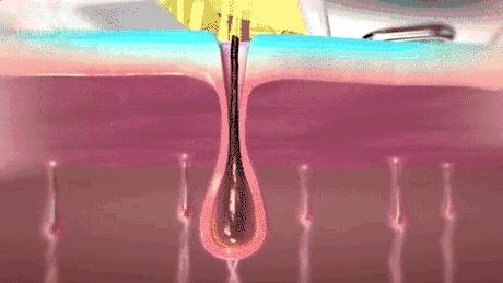 j-style脱毛仪,j-style脱毛仪怎么样