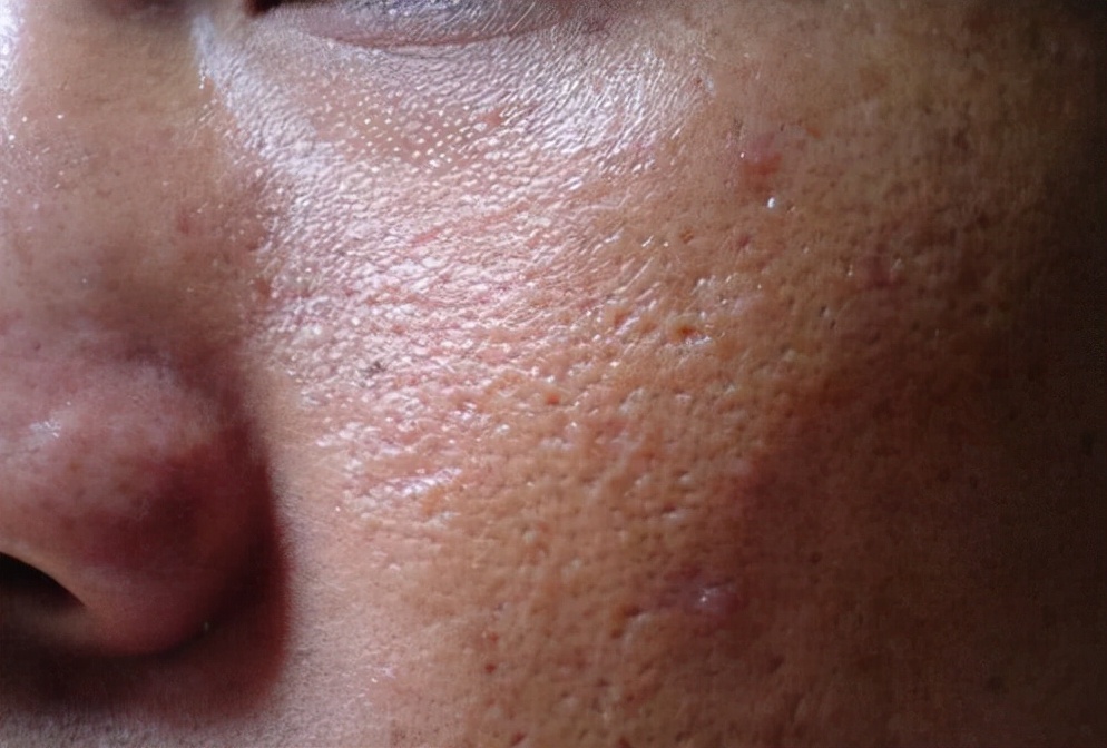 肺部出现六种情况要当心,肺部受伤会有怎样的表现