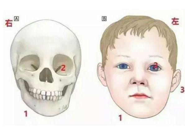 宝宝脖子歪了怎么判断斜颈,婴儿脖子斜颈和骨头歪怎么办