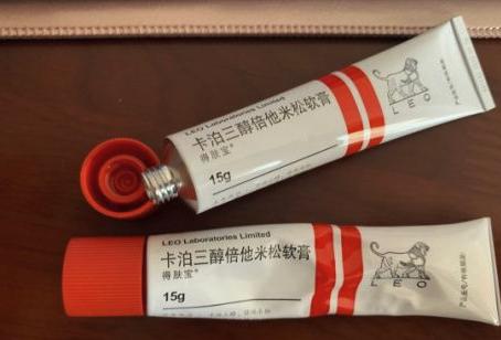 牛皮癣患者的治愈经历,牛皮癣患者亲身治愈经历