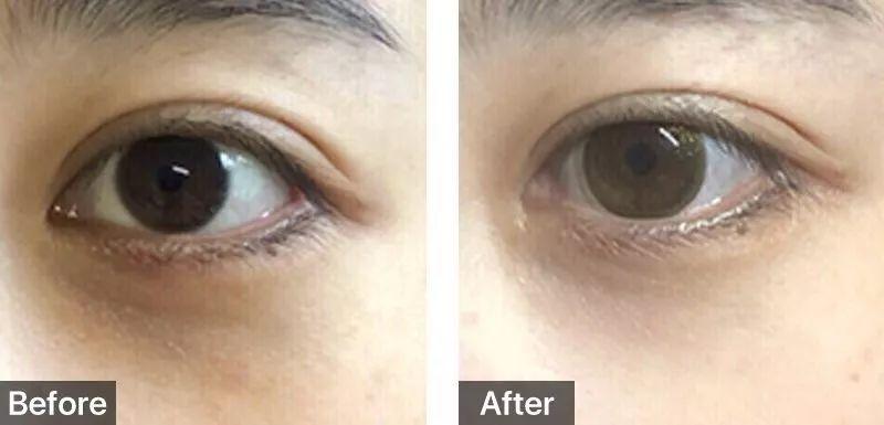 她靠“脸崩”博出位，曾经的女王要“凉凉”