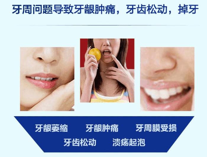 牙周炎牙疼的最佳治疗方法,牙周炎牙疼怎么治疗最有效好得快