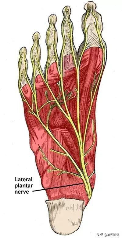 病理脚麻的最快恢复方法,脚麻诊断思路
