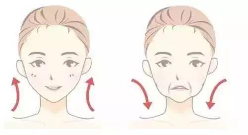 大眼袋面部凹陷法令纹有救吗,法令纹严重的宝宝有救了