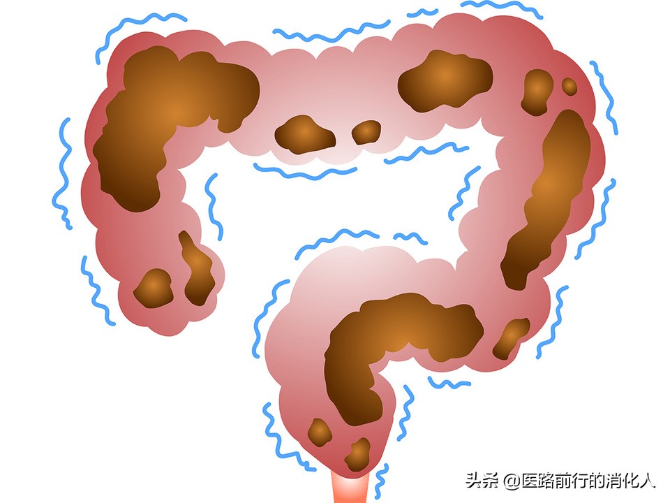 治便秘最彻底的偏方老年人便秘,老年人便秘的最佳治疗方法