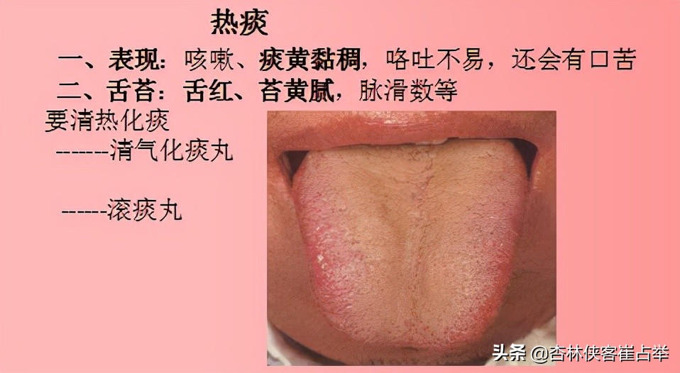 痰在肺则咳痰在胃则呕的意思,肺痰与胃痰