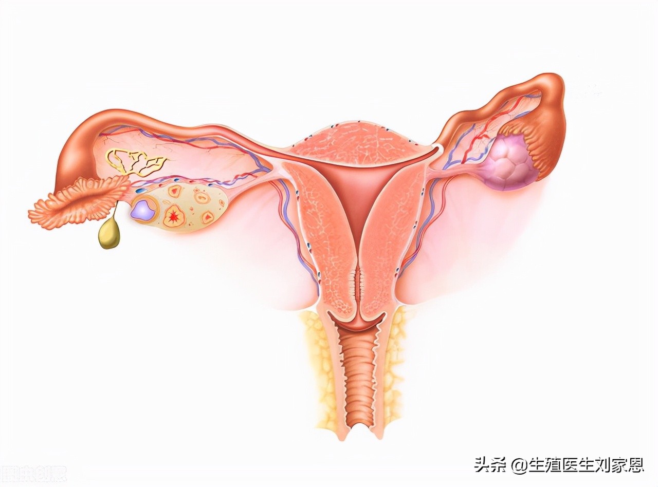 卵巢储备功能低下怎么办？如何备孕？生殖医生解读
