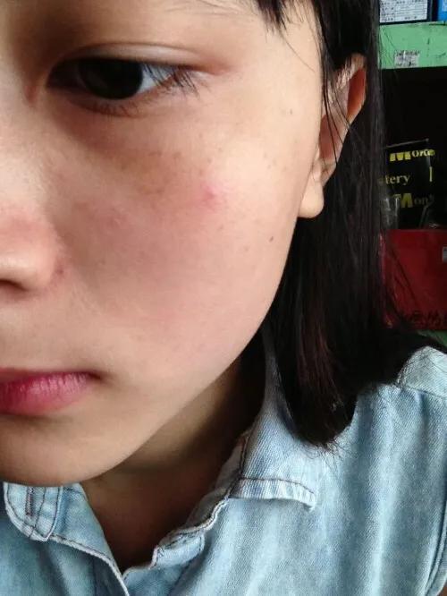 不想被老年斑困扰,不想被老年斑困扰怎么办