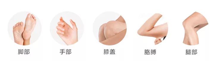 脚后跟老茧怎么去除,我的脚后跟有老茧变硬有细微开裂