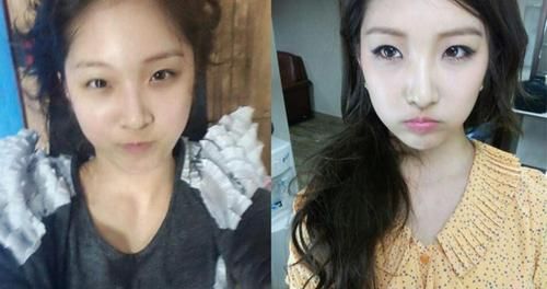 面部微整形的危害,为什么微整形面部变残