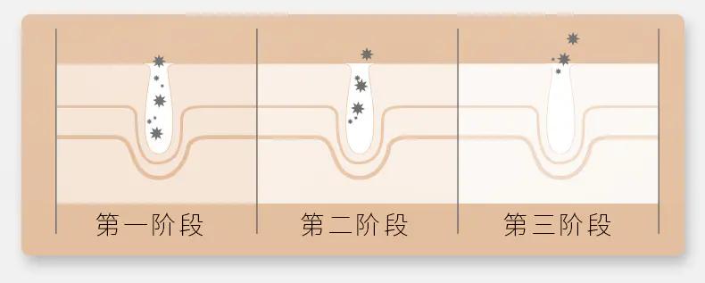 能放进包包的“美容院”,随时淡纹护眼,素颜美女少不了它