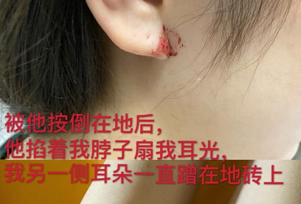 张培萌100米跑赢苏炳添,张培萌飞人事件