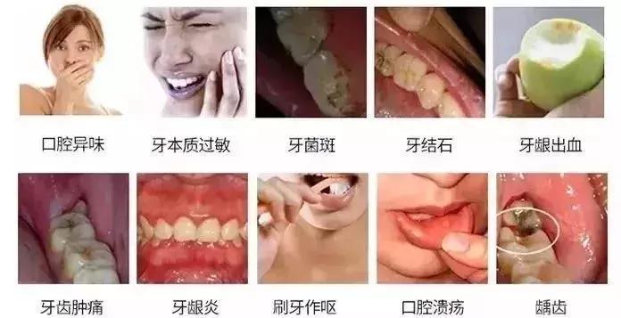 一口黄牙毁了一张脸视频,一口黄牙影响颜值